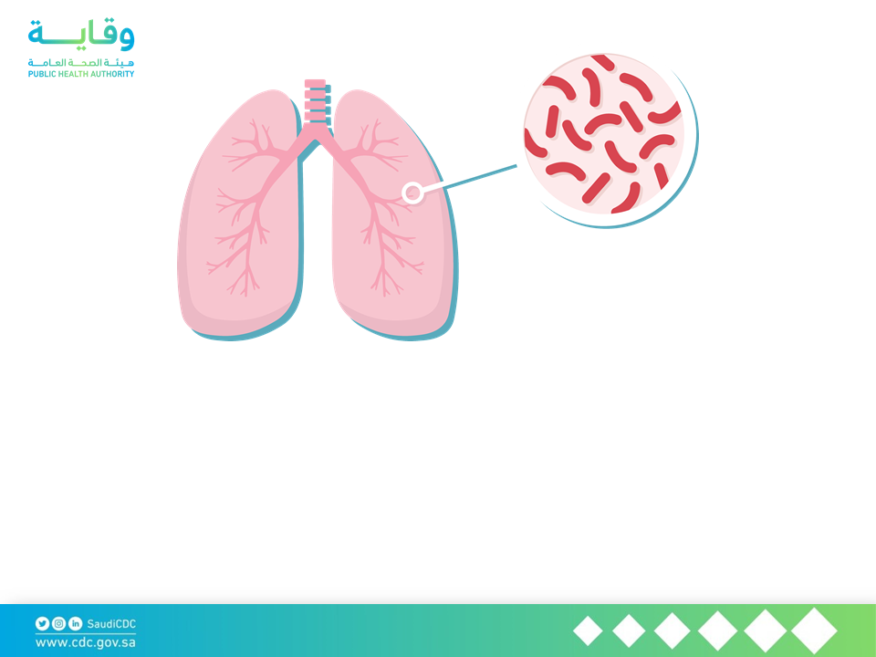 Overview and Progress Update of Tuberculosis